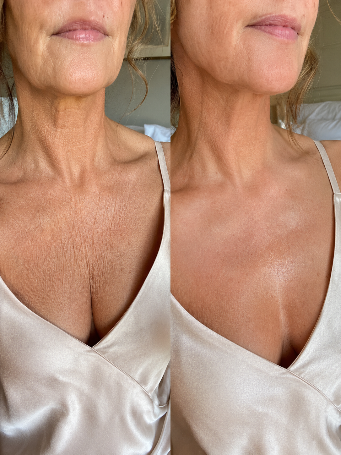 Before and after result 4