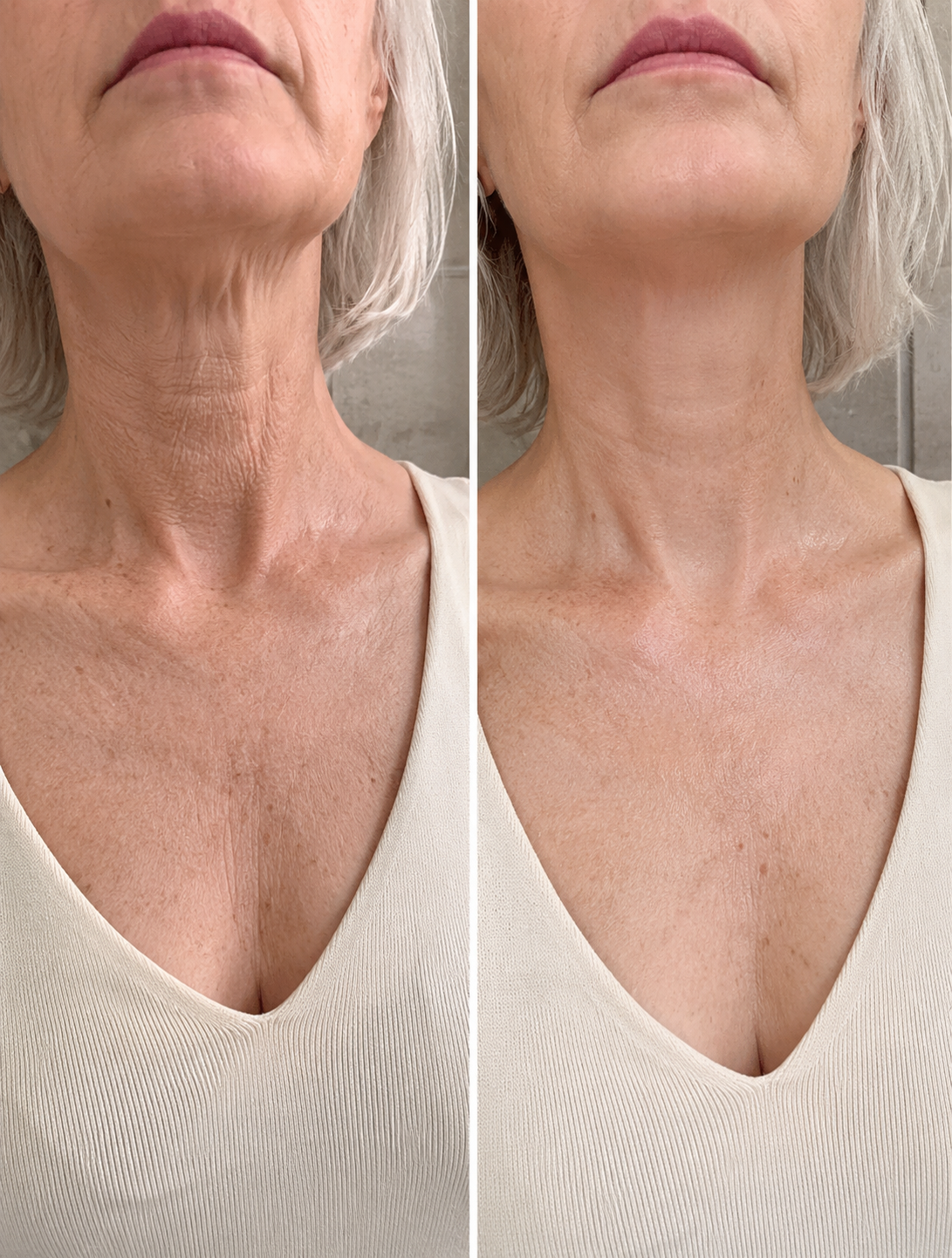 Before and after result 6