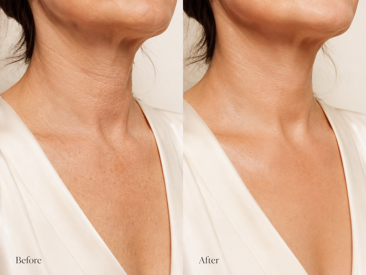 Before and after — neck and décolleté