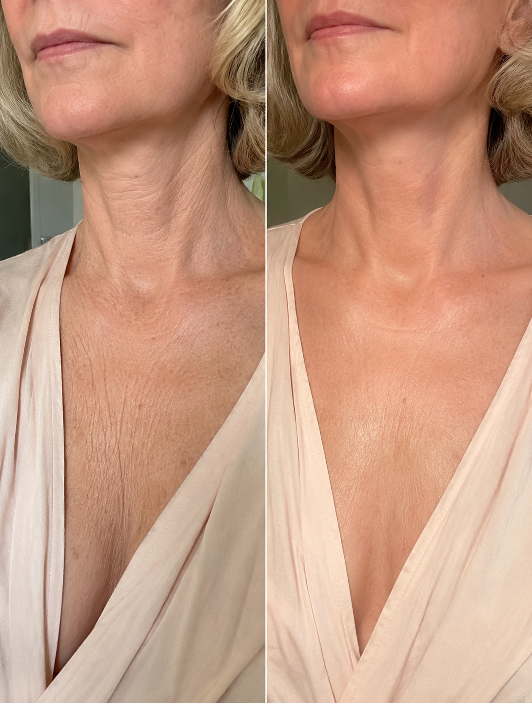 Before and after result 1